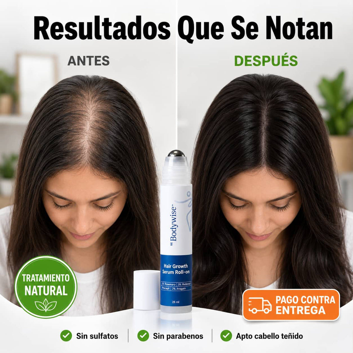 Suero Capilar de Romero Bodywise | Frena la Caída y Reactiva el Crecimiento Natural