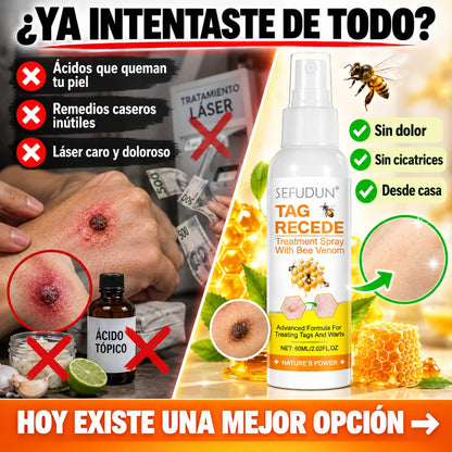 Spray Quita Verrugas con Veneno de Abeja | Elimínalas Sin Dolor Desde Tu Casa
