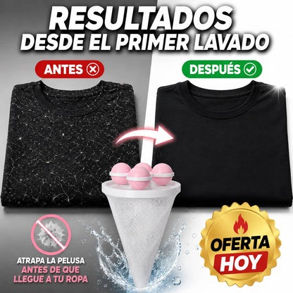 Filtro Atrapa Pelusas para Lavadora | Ropa Más Limpia Sin Esfuerzo Desde el Primer Lavado
