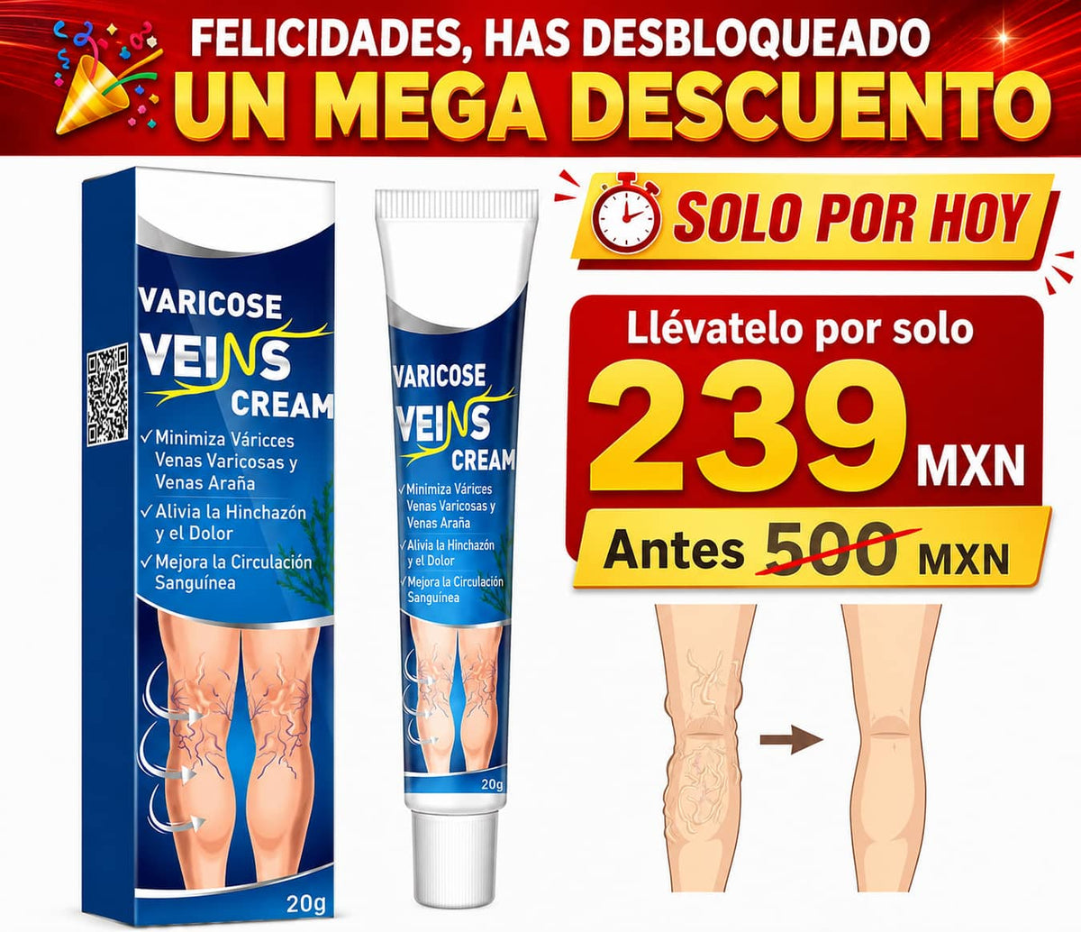 ⚡Crema para Aliviar Varices +50% OFF🔥