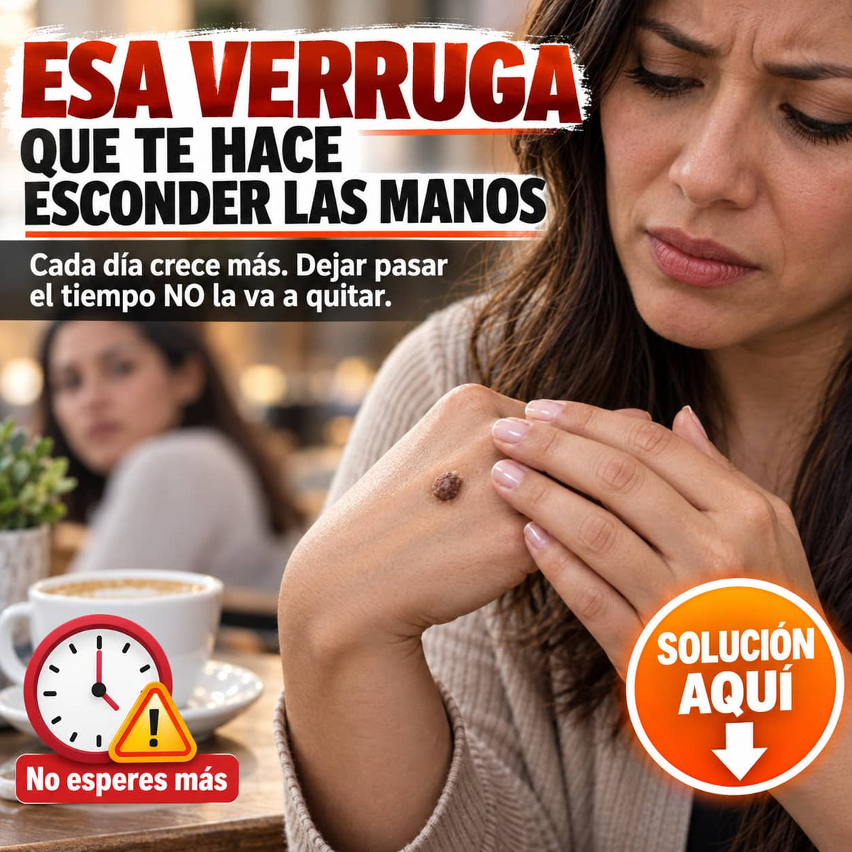Spray Quita Verrugas con Veneno de Abeja | Elimínalas Sin Dolor Desde Tu Casa